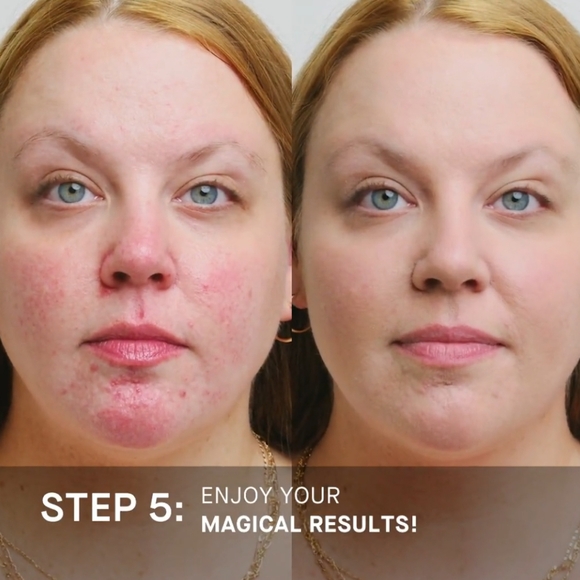 "IL Makiage" Power Camo Redness Defense Age & Redness Control Primer Treatment - Picture 8 of 9